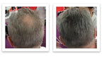 Hair Fibers For Hair Loss. Cover Bald Spot and Thinning Hair Instantly. Make Thin Hair Look 10X Fuller. All-Natural Hair Building Fiber. Trial Size (10-Day Supply). Dark Gray