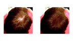 Thinning Hair Solution - All-Natural, Plant-Based Fibers For Fuller, Thicker Appearance. Instantly Covers Bald Spots. Auburn (red/ginger hair). Trial Size, 10-Day Supply