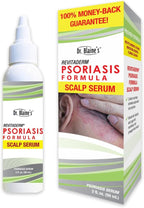Dr. Blaine's Scalp Psoriasis Serum, Eliminate Itching, Scaling, Flaking, Redness - Fragrance-Free, Paraben-Free - Sal Acid & Allantoin - Travel Size 2 oz.