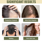 Hair Growth System, With Ginseng, Peppermint Oil and Ginger Root Treatment-Advanced Scalp Care Formula Thickening Serum. Strengthens Roots, For Men & Women.