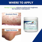 5 Psoriasis Cream - Full Body 5% Salicylic Acid Exfoliating Skin Lotion - Promotes Relief from Itchy, Redness, Dryness, Roughness, and Flakey Skin