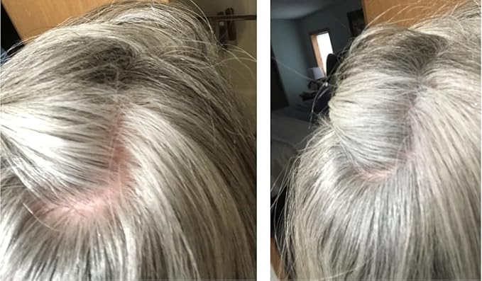 Hair Loss Concealer. Covers Bald Spot And Makes Thin Hair Look 10X Fuller Instantly. All-Natural Hair Building Fiber. Trial Size, 10-Day Supply. Gray