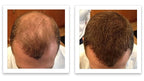 Thinning Hair Solution - All-Natural, Plant-Based Fibers For Fuller, Thicker Appearance. Instantly Covers Bald Spots. Auburn (red/ginger hair). Trial Size, 10-Day Supply