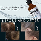 Tricho Labs Folliboost Hair Growth Serum - Natural-Based Formula w/Biotin & Peppermint Oil - Hair Care for Thicker & Fuller Hair - 2oz, 6-Pack