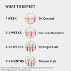 0.5% KINTOR KX-826 Hair Growth Spray,Oil Control Strengthen Hair,Hair Regrowth Products for Women&Men,Basic,60ml