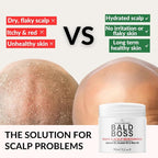 Bald Brothers Daily Bald Head Care with Apricot Seed Oil | Mattifying, vegan, no grease | Bald Boss everyday Face & Head Moisturizer | No Fragrance