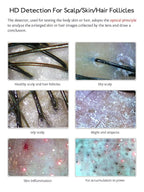 Skin Hair Scalp Detector Hair Follicle Facial Skin Oil Moisture 11 Inch HD LCD Screen Microscope Tester