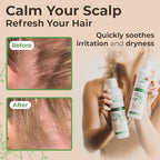 Wild Naturals Eczema and Psoriasis Treatment - Anti-Dandruff Deep Conditioner for Damaged, Dry Hair and Seborrheic Dermatitis Scalp