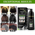 Dexe Hair Dye Shampoo 14.1 Fl Oz, Gray Hair Coverage, Black Hair Dye, Hair Color Shampoo, Black Hair Shampoo for Men & Women