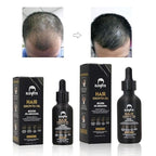Elevate Hair Regrowth Treatment 5% Minoxidil Solution - Biotin Serum Hair Growth Oil for Men & Women - Thicker Fuller Stronger Hair - Stops Hair Loss & Thinning - Natural Hair Thickening Treatment 1oz