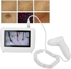 Skin Hair Analyser,5 in 50X/200xLens LCD Digital Microscope Rechargeable Portable Scalp Detector Scanner Professional Scalp Hair Follicle Oil Moisture Magnifying Detector Skin Pigment Tester,US