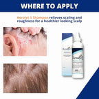 5 Anti-Dandruff Shampoo - Max Strength 5% Salicylic Acid Scalp Build-Up Clearing - Promotes Relief from Dandruff, Psoriasis, Seborrheic Dermatitis, Dryness, and Itchiness, 177 milliliters