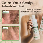 Wild Naturals Psoriasis Shampoo for Scalp Care & Relief – Hydrating Anti-Dandruff Shampoo for Itchy, Dry Scalp – Gentle Eczema Shampoo for Sensitive Skin