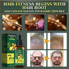 Vedora Ginger Oil for Hair Growth - Biotin Hair Growth Serum, 100% Pure Natural Ginger Essential Oil - Promotes Stronger, Thicker, Longer Hair in Women & Men - 3.0 Fl Oz / 90ML (3pc+Roller)
