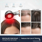 Multi Functional 3 in 1 Electric Scalp Massager Hair Growth, Red Light Therapy Scalp Massager with Oil Applicator, Portable Smart Scalp Hair Brush IPX7 Waterproof