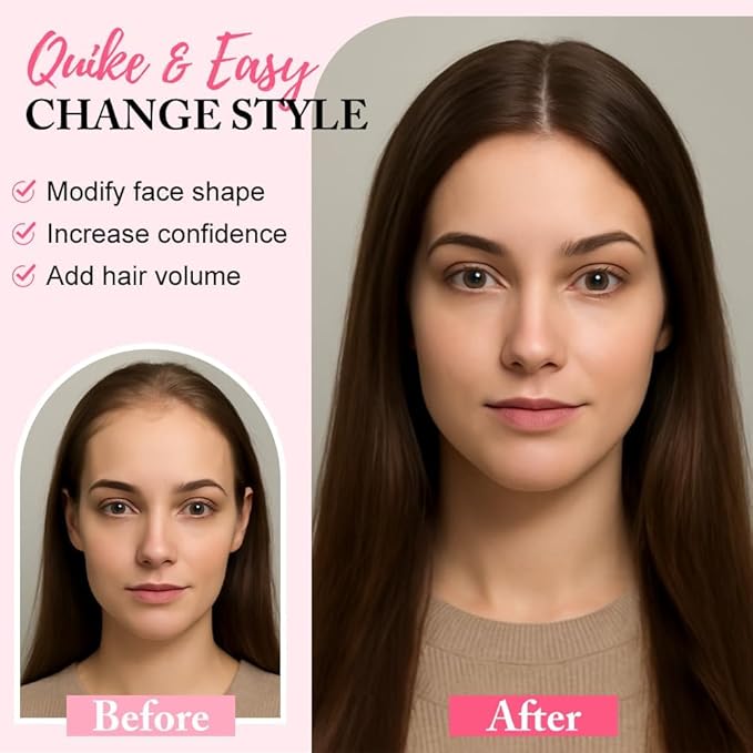 Hair Toppers for Women Real Human Hair Topper for Women with No Bangs Hairpieces Comfortable and Breathable 10 Inch Swiss Base 3D 360°Cover (Medium Auburn Brown, 10 Inch-3D-Side)
