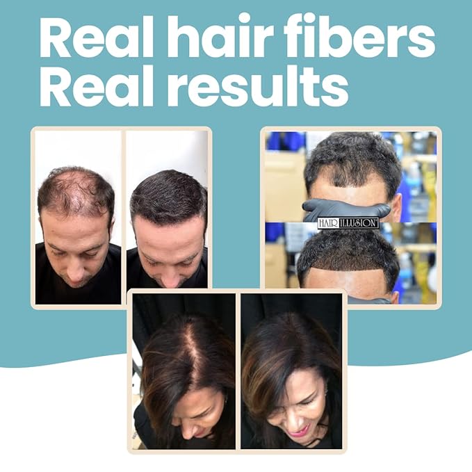 Hair Illusion Dark Brown Real Hair Fibers for Thinning Hair - 100% Natural Texture, Non Synthetic Hair Fibers - Bald Spot Cover Up for Women & Men - 38 Gram