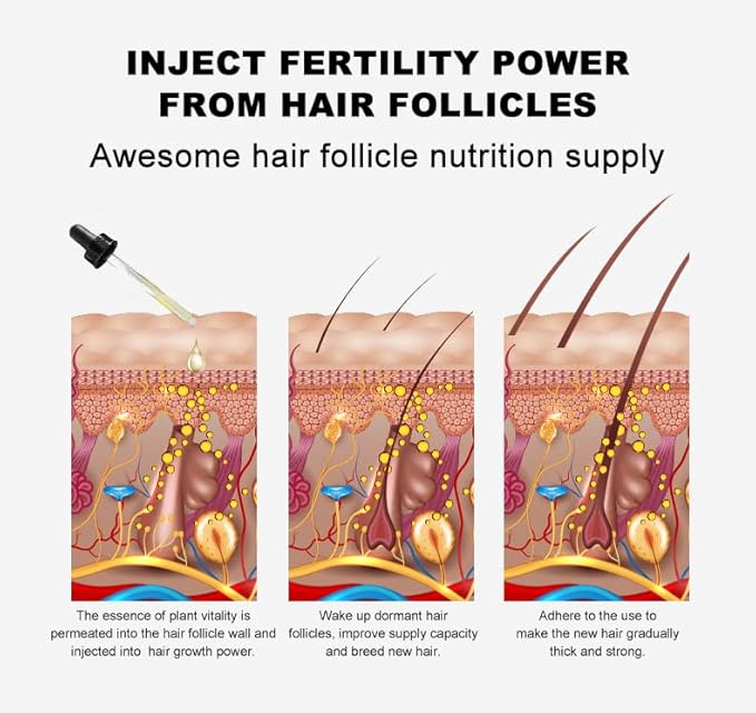 Vedora Ginger Oil for Hair Growth - Biotin Hair Growth Serum, 100% Pure Natural Ginger Essential Oil - Promotes Stronger, Thicker, Longer Hair in Women & Men - 3.0 Fl Oz / 90ML (3pc+Roller)