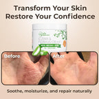 Wild Naturals Eczema & Psoriasis Cream for Dry, Itchy Skin – Eczema Relief for Adults & Kids – Moisturizing Psoriasis Cream with Manuka Honey - Hydrating Honey Lotion for Hands and Face