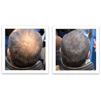 Trial Size - Make Thin Hair Look 10X Fuller. Eliminate Bald Spot and Thinning Hair Instantly. All-Natural Hair Concealer. Salt & Pepper - Light