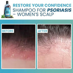 Sphagnum Botanicals Psoriasis Shampoo with Salicylic Acid - Natural Scalp Treatment for Dry, Itchy, Flaky Scalp with Menthol & Peat Mud – Sulfate-Free, Gentle Formula – 13.5 fl oz