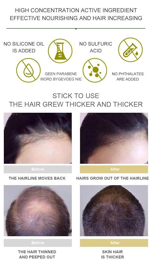 Vedora Ginger Oil for Hair Growth - Biotin Hair Growth Serum, 100% Pure Natural Ginger Essential Oil - Promotes Stronger, Thicker, Longer Hair in Women & Men - 2.0 Fl Oz / 60ML (2 PCS)