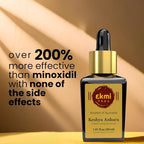 Hair Growth Dht Blocker Serum With Redensyl, Procapil, Ayurvedic Herbs, Amla, Brahmi, Capilia Longa. Follicle Stimulating Serum. Hair Loss Treatment For Women & Men, Thicker Hair 1.01 Fl Oz