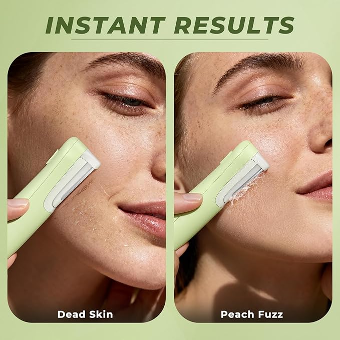 Dermaplane Razor for Women Face, WLU Rechargeable Face Dermaplaning Tool – Peach Fuzz, Facial Hair & Exfoliation Removal, Sonic Technology with LED Light, 3 Speeds & 10 Blades (Green)