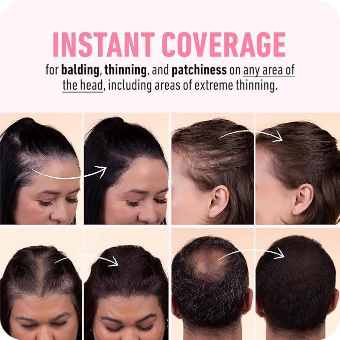 BOLDIFY Hairline Powder (LARGE, 10g) - Root Touch Up Hair Color for Gray Coverage - Bald Spot Concealing Hair Powder for Women & Men - 24-Hour Stain-Proof - Dark Gray