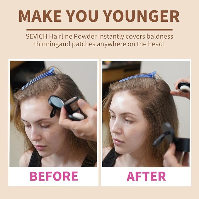 SEVICH Instantly Hairline Shadow Hairline Powder, Quick Cover Grey Hair Root Concealer, Eyebrows & Beard Line, Hair Root Touch Up for Thinning Grey Hairline, Windproof&Sweatproof, Dark Brown