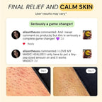 MyMagicHealer Thyme & Tea Tree Flare Care | Ingrown Hair, Razor Bumps, Blind Pimples, Bartholin, Pilonidal Cysts | Folliculitis Cure | Piercing Care w/Egg Yolk Extract & Tea Tree 1 oz