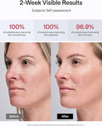 JMOON Microcurrent Facial Device, M30U Red Light Therapy for Face, Safe Anti Aging Skin Care, 4 Modes, 5 Energy Levels for Full Face Lift and Ideal for Smile Lines, Eyes, and Forehead (Pink)