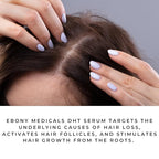 Ebony Medical DHT Blocker Hair Growth Serum for Thinning Hair – Hair Regrowth Treatment for Men & Women – Procapil Formula – Thickens Fine Hair – Liposomal Scalp Serum – 2 fl oz