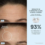 NuFACE Trinity+ Microcurrent Facial Device + LED Red Light Wrinkle Reducer Attachment - FDA Cleared Skin Tightening Device + Microcurrent Gel Activator & Silk Creme