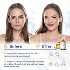 HIQILI 30ML Chamomile Essential Oil, Pure & Natural Chamomile Oil for Diffueser, Skin, Soap, Shampoo - 1.01 Fl Oz