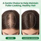 Hair Growth Care Serum Roll-On with Rosemary, Niacinamide, Amino Acids, Ginger, Biotin, Castor Oil, Batana & Caffeine, Nourishes Scalp for Thicker-Looking, Healthy Hair, 30ml/1.01 fl.oz