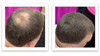 Hair Building Fiber. Cover Bald Spot and Thinning Hair Instantly. 10X Fuller Hair. All-Natural, Organic Hair Loss Concealer. Trial Size (10-Day Supply). Medium Brown