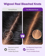 9x6 SKINLIKE Real HD Lace Closure Wig, Water Wave 180% Density 0.10mm Ultra-thin Swiss Lace Pre-plucked Bleached Small Knots With Baby Hair Glueless Wigs Human Hair Wigs 26 Inch