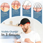 Red Light Hair Growth Device,Laser Hair Growth Cap, Red Light Therapy for Hair Growth, Red Light Cap for Thicker Hair in Men and Women