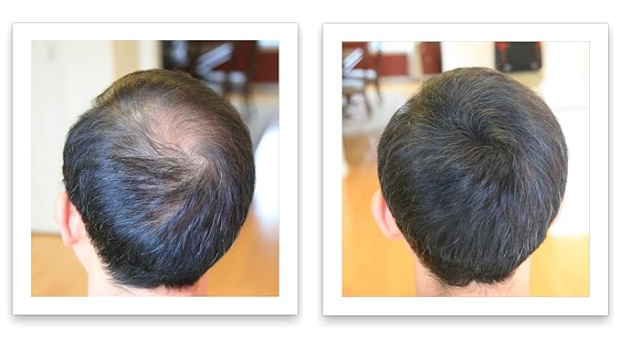 Caboki Healthful Powder Volumizer for Men & Women: Thinning Hair Solution for Root Touch Up, Hairline & Edges, Covering Hair Loss, Bald Spots & Gray Hair - TALC-Free,