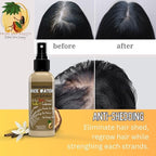 Rice Water Hair Growth Spray – Vanilla Cedarwood | Rosemary, Caffeine & Biotin Infused | Hair & Scalp Treatment for Thicker, Fuller Hair | Non-Greasy, Vegan Formula (4 oz)