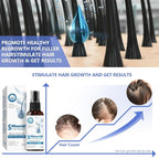 Minoxidil for Men, 5% Hair Growth Serum for Men And Women Combat Hair Loss and Thinning, Supports Thicker and Fuller Hair & Beard, 60ml