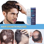 Minoxidil 5% Foam for Hair Growth, Topical Hair Loss Treatment for Men and Women, 3 Pack (2 oz Bottle) (1PC)