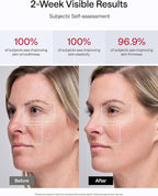JMOON Microcurrent Facial Device, M30U Red Light Therapy for Face, Safe Anti Aging Skin Care, 4 Modes, 5 Energy Levels for Full Face Lift and Ideal for Smile Lines, Eyes, and Forehead (Red)