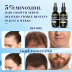 5% Minoxidil Spray for Men and Women Hair Loss Solution with Biotin and Rosemary Hair Growth Serum (Glass Bottle), Extra Strength 5 Percent Minoxidil for Thicker Fuller Hair Regrowth Treatments