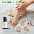 Organic Tea Tree Oil for Skin, Hair, Face, Scalp, Nails, 100% Pure Australian Tea Tree Essential Oil for Room Linen Spray, Diffuser -1 Oz