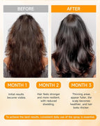 Hair Growth Spray, Hair Growth Oil Spray, with Biota Orientalis, Rosemary Oil & Biotin, Strengthens Hair Roots, Prevent Hair Thinning & Loss, Thicker Fuller Hair for Women & Men (1 pack, 3% Rosemary)