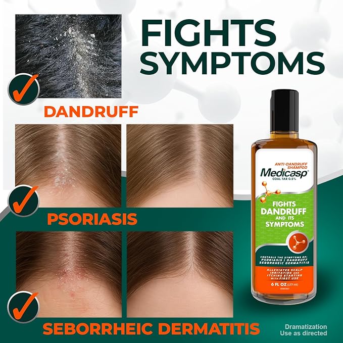 Medicasp Coal Tar Anti-Dandruff Shampoo, Alleviates Symptoms from 1st Wash, Treats Psoriasis, Seborrheic Dermatitis & Itchy Dry Scalp, Fights the Root Cause of Dandruff, Flakes Shampoo, 6 fl oz