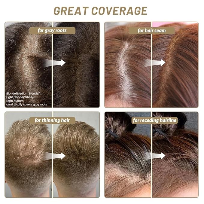 SOVONCARE Hairline Powder - Root Touch Up & Gray Hair Concealer for Men and Women, Instantly Covers Thinning Hair and Bald Spots, Natural-Looking Coverage Hazel Brown