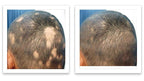 Caboki Hair Volumizer: Root Touch Up & Fill in Thinning Hairline, Cover Bald Spots & Gray Hair. TALC-Free, Healthful Powder for Men & Women. Golden Blonde